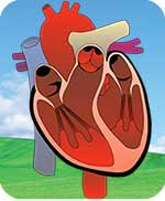 Heart disorders