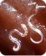 Hook worms