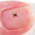 Lyme disease carrying tick on a fingernail